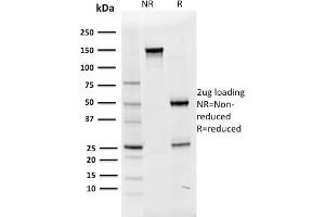 SDS-PAGE Analysis Purified Oct-2 Mouse Monoclonal Antibody (OCT2/2136). (Oct-2 抗体  (AA 112-297))