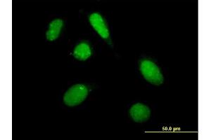 Immunofluorescence of purified MaxPab antibody to PHF20L1 on HeLa cell. (PHF20L1 抗体  (AA 1-285))