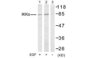 Western blot analysis of extracts from 293 cells (Lane 1) and MDA-MB-435 cells (Lane 2 and 3), untreated or treated with EGF, using IKKα (Ab-23) antibody (E021123). (IKK alpha 抗体)