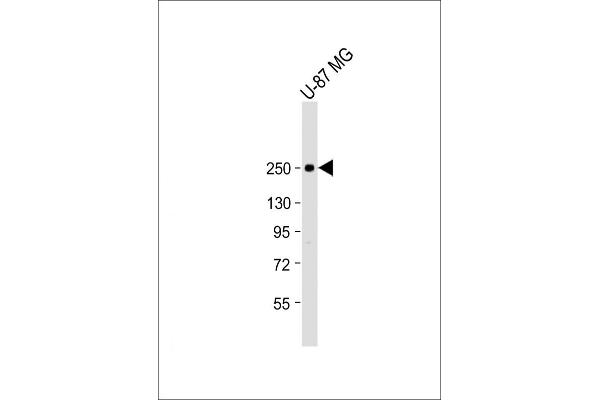 SCN1A Antikörper  (AA 481-515)