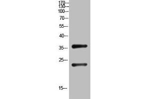 Western Blot analysis of customer's (cat sample) using QM Polyclonal Antibody. (PRL3D1 抗体  (N-Term))