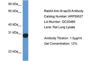 Western Blotting (WB) image for anti-Synaptosomal-Associated Protein, 29kDa (SNAP29) (Middle Region) antibody (ABIN2788104) (SNAP29 抗体  (Middle Region))