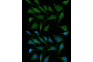 Immunofluorescence analysis of L929 using TRIM45 antibody (ABIN6132737, ABIN6149529, ABIN6149530 and ABIN6216483) at dilution of 1:100 (40x lens). (TRIM45 抗体  (AA 100-400))