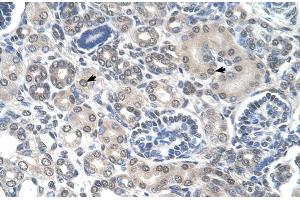 Immunohistochemistry (IHC) image for anti-Phosphoribosyl Pyrophosphate Amidotransferase (PPAT) (N-Term) antibody (ABIN2782471)