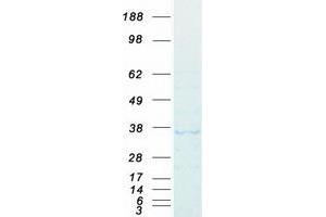 DAZL Protein (Myc-DYKDDDDK Tag)