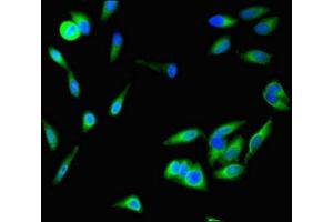 Immunofluorescent analysis of Hela cells using ABIN7168677 at dilution of 1:100 and Alexa Fluor 488-congugated AffiniPure Goat Anti-Rabbit IgG(H+L) (SFRP1 抗体  (AA 170-240))