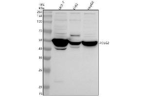 Western blot analysis of POLG2 using anti-POLG2 antibody (ABIN7825706).