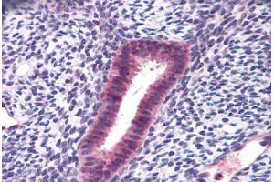 Human Uterus: Formalin-Fixed, Paraffin-Embedded (FFPE) (FOXN1 抗体  (AA 585-648))