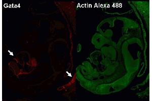 Following antigen retrieval with Retrievagen A (pH 6. (GATA4 抗体)