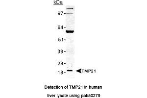 Image no. 2 for anti-Transmembrane Emp24-Like Trafficking Protein 10 (TMED10) (AA 100-200) antibody (ABIN363588) (TMED10 抗体  (AA 100-200))