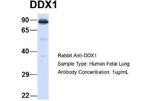 Host:  Rabbit  Target Name:  DDX1  Sample Type:  Human Fetal Lung  Antibody Dilution:  1. (DDX1 抗体  (Middle Region))