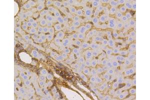 Immunohistochemistry (Paraffin-embedded Sections) (IHC (p)) image for anti-Solute Carrier Family 2 (Facilitated Glucose Transporter), Member 1 (SLC2A1) antibody (ABIN5997112)