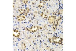 Immunohistochemistry of paraffin-embedded rat kidney using DNMT3A antibody at dilution of 1:200 (400x lens). (DNMT3A 抗体)