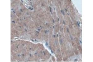 Immunohistochemistry (IHC) image for anti-Orosomucoid 1 (ORM1) (AA 20-186) antibody (ABIN7428032)