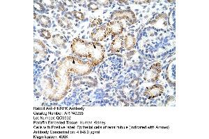 Rabbit Anti-HNRPK Antibody  Paraffin Embedded Tissue: Human Kidney Cellular Data: Epithelial cells of renal tubule Antibody Concentration: 4. (HNRNPK 抗体  (N-Term))