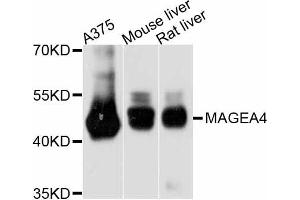 Western blot analysis of extracts of various cell lines, using MAGEA4 antibody. (MAGEA4 抗体)
