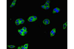 Immunofluorescent analysis of HepG2 cells using ABIN7154617 at dilution of 1:100 and Alexa Fluor 488-congugated AffiniPure Goat Anti-Rabbit IgG(H+L) (HRAS 抗体  (AA 12-181))