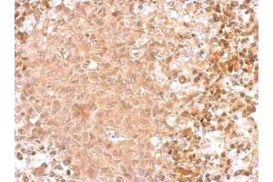 IHC-P Image GAD65 antibody [C2C3], C-term detects GAD2 protein at cytosol on RT2 xenograft by immunohistochemical analysis. (GAD65 抗体  (C-Term))