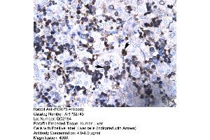 Immunohistochemistry (IHC) image for anti-Forkhead Box P3 (FOXP3) (N-Term) antibody (ABIN2777561)
