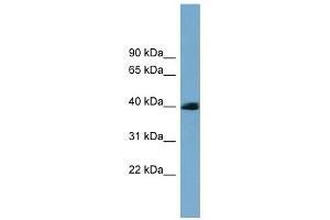 CXORF9 antibody used at 1 ug/ml to detect target protein.