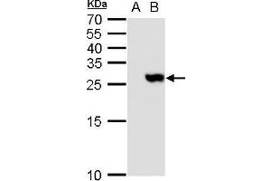WB Image TMS1 antibody detects TMS1 protein by western blot analysis. (PYCARD 抗体)