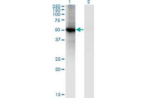 Western Blot analysis of RORB expression in transfected 293T cell line by RORB monoclonal antibody (M01), clone 4B4. (RORB 抗体  (AA 136-224))