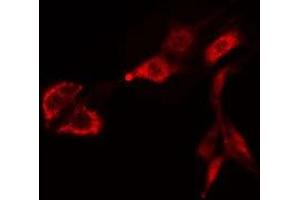 ABIN6275468 staining Hela cells by IF/ICC. (RAB38 抗体  (Internal Region))