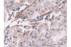 Immunohistochemistry (IHC) image for anti-Transgelin (TAGLN) (AA 1-201) antibody (ABIN7435139)