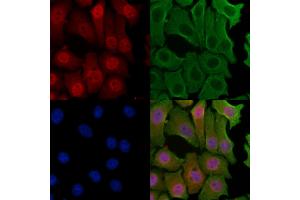 ABIN6257658 and ABIN6274323 staining Hela cells by IF/ICC. (NCBP1 抗体  (N-Term))