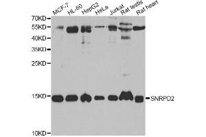 Western blot analysis of extracts of various cell lines, using SNRPD2 antibody (ABIN2560047) at 1:1000 dilution. (SNRPD2 抗体)