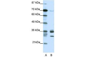 CDK5 antibody (20R-1202) used at 0. (CDK5 抗体  (C-Term))