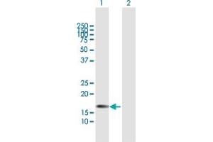 Western Blot analysis of CSF3 expression in transfected 293T cell line by CSF3 MaxPab polyclonal antibody. (G-CSF 抗体  (AA 1-207))