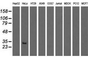 Western blot analysis of extracts (35 µg) from 9 different cell lines by using anti-GSTT2 monoclonal antibody. (GSTT2 抗体)