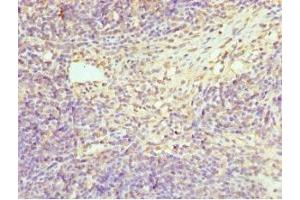 Immunohistochemistry of paraffin-embedded human thymus tissue using ABIN7155076 at dilution of 1:100 (HPS1 抗体  (AA 1-324))