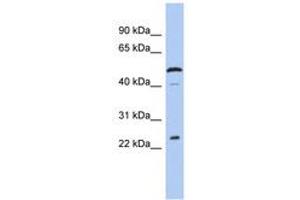 Chromosome 1 Open Reading Frame 190 (C1orf190) (AA 143-192) antibody