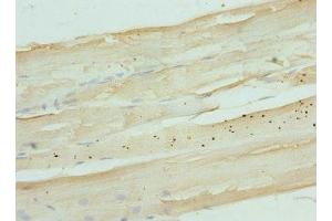 Immunohistochemistry of paraffin-embedded human skeletal muscle tissue using ABIN7165854 at dilution of 1:100 (NDRG2 抗体  (AA 152-371))