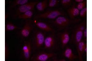 Immunofluorescence staining of methanol-fixed Hela cells using Myc(Phospho-Thr358) Antibody. (c-MYC 抗体  (pThr358))