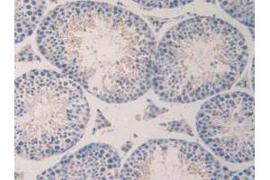 IHC-P analysis of Mouse Testis Tissue, with DAB staining. (CCL7 抗体  (AA 28-97))