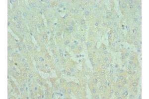 Immunohistochemistry of paraffin-embedded human liver tissue using ABIN7172290 at dilution of 1:100 (TIRAP 抗体  (AA 1-221))