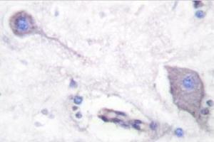 Image no. 2 for anti-Signal-Regulatory Protein alpha (SIRPA) antibody (ABIN271815) (SIRPA 抗体)