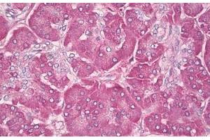 Image no. 2 for anti-GTPase NRas (NRAS) (AA 91-140) antibody (ABIN6749779) (GTPase NRas 抗体  (AA 91-140))