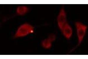 ABIN6278554 staining 293 cells by IF/ICC. (AWAT1 抗体  (Internal Region))