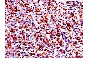 Immunohistochemistry of paraffin-embedded human pancreatic tissue using ABIN7154138 at dilution of 1:100 (GAPDH 抗体  (AA 3-335))