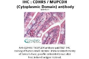 Image no. 1 for anti-Mucin and Cadherin-Like (CDHR5) (Cytoplasmic Domain) antibody (ABIN1732921) (CDHR5 抗体  (Cytoplasmic Domain))