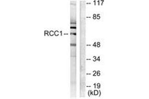 Western blot analysis of extracts from LOVO cells, using RCBTB1 Antibody. (RCBTB1 抗体  (AA 251-300))