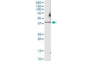 Immunoprecipitation of CDK6 transfected lysate using anti-CDK6 MaxPab rabbit polyclonal antibody and Protein A Magnetic Bead , and immunoblotted with CDK6 MaxPab mouse polyclonal antibody (B01) . (CDK6 抗体  (AA 1-326))