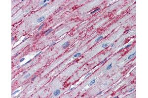 Immunohistochemistry (IHC) image for anti-Polyribonucleotide Nucleotidyltransferase 1 (PNPT1) (Middle Region) antibody (ABIN2776602) (PNPT1 抗体  (Middle Region))