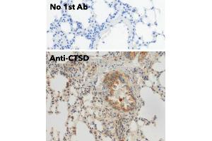 Immunohistochemistry (IHC) image for anti-Cathepsin D (CTSD) (C-Term) antibody (ABIN6254162)