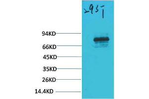 Western Blotting (WB) image for anti-Signal Transducer and Activator of Transcription 3 (Acute-Phase Response Factor) (STAT3) antibody (ABIN3188049) (STAT3 抗体)