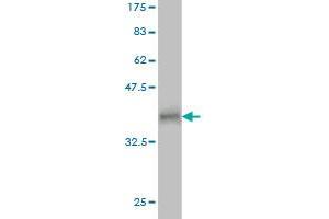 Western Blot detection against Immunogen (37. (RNF17 抗体  (AA 30-139))